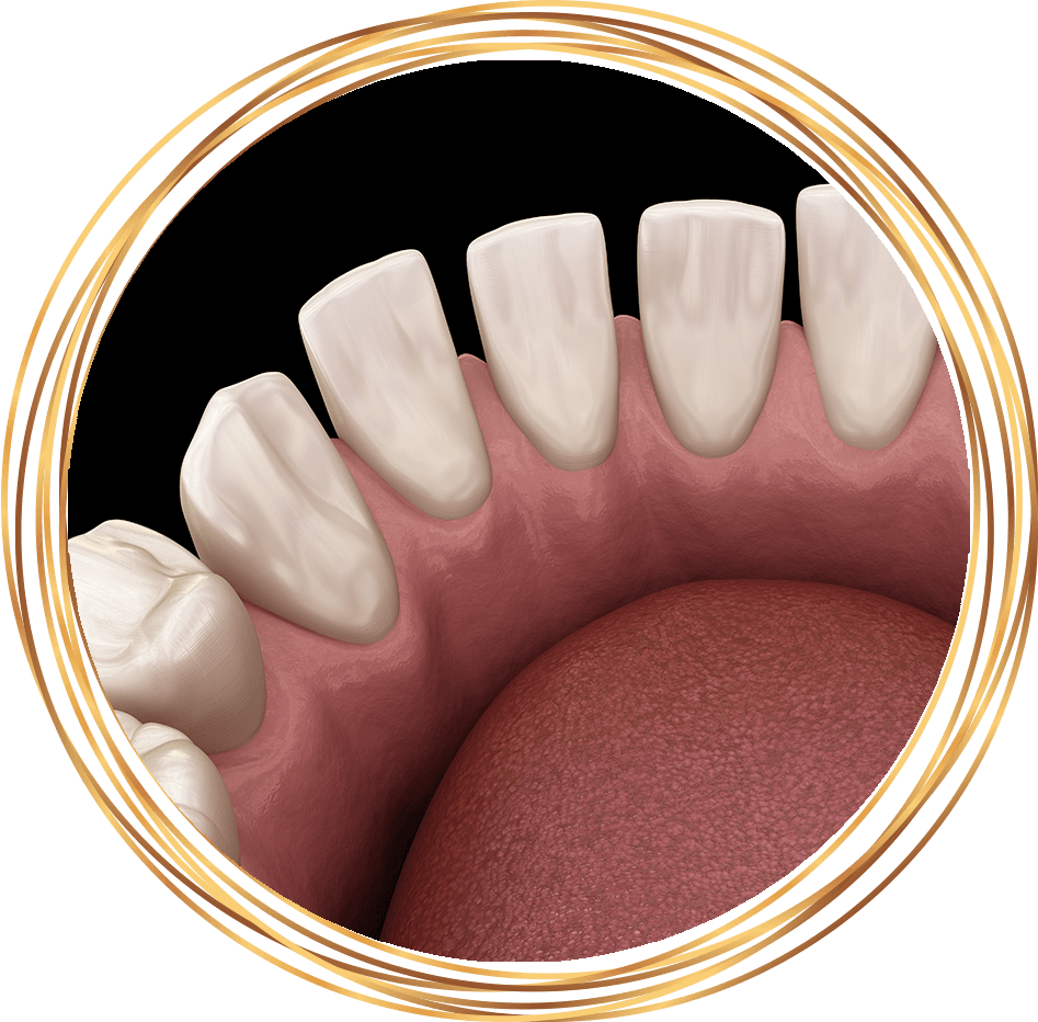 gapped teeth