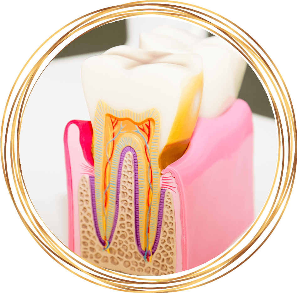 tooth roots in dental model