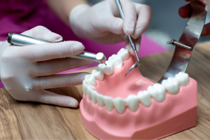 Shasta Family Dentistry|What Are Full Mouth Dental Implants? Is “Whole Mouth Dental Implants” Right for You?